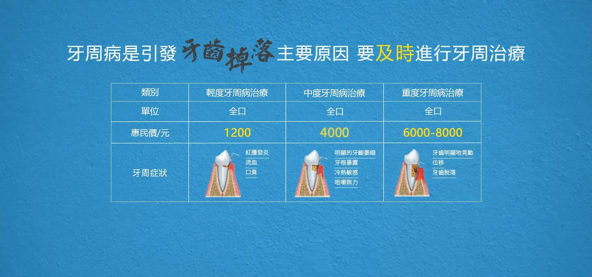 澳門牙周病治療收費
